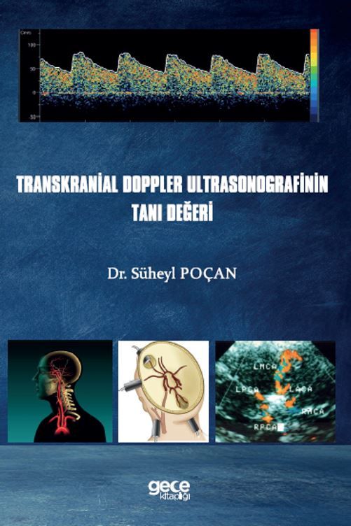 Transkranial Doppler Ultrasonografinin Tanı Değeri kapağı